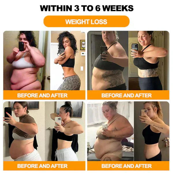 Bee Venom Detox & Sliming Patches (10 Patches)